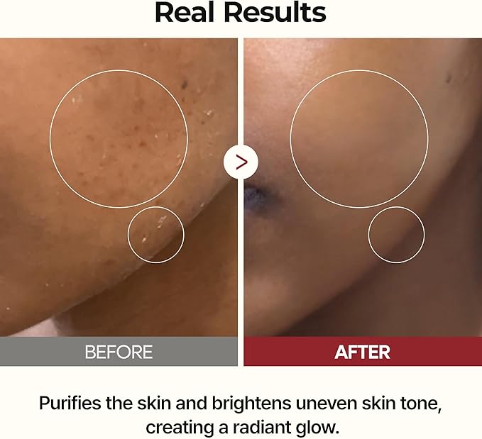 Dr. Melaxin Rice Peel Ampoule