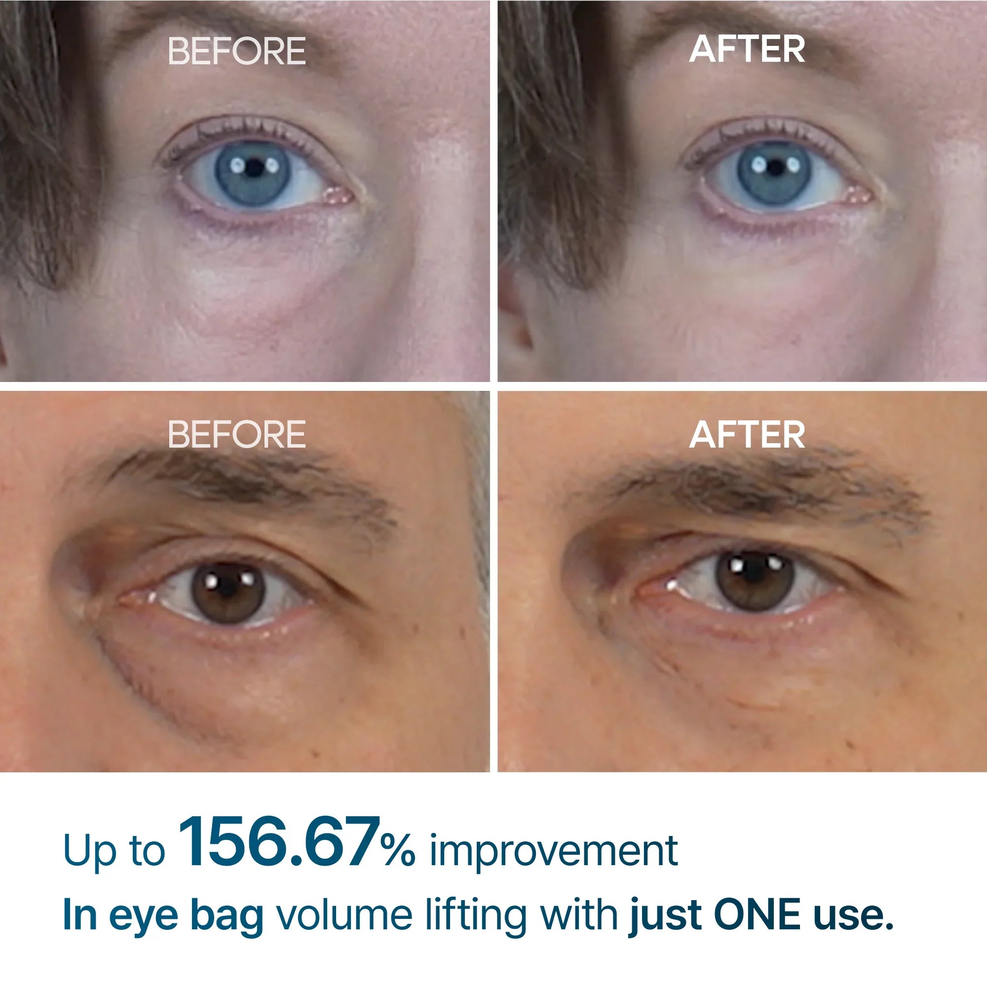 Eyephalt Eyebag Cream